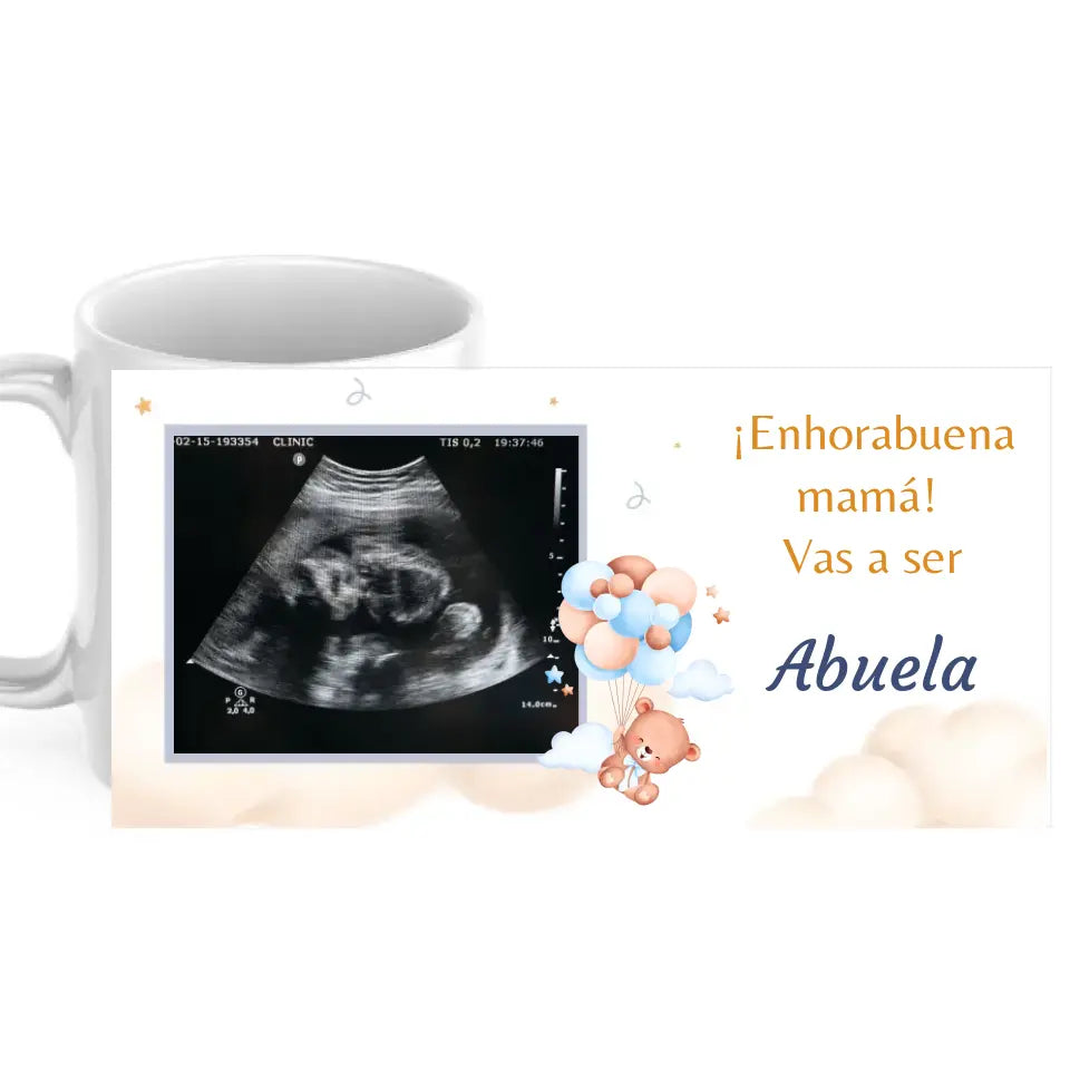 Taza ecografía anuncio embarazo personalizable