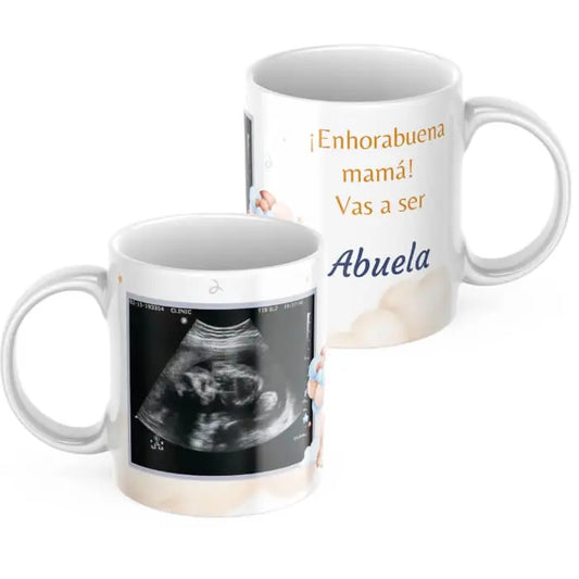 Taza ecografía anuncio embarazo personalizable