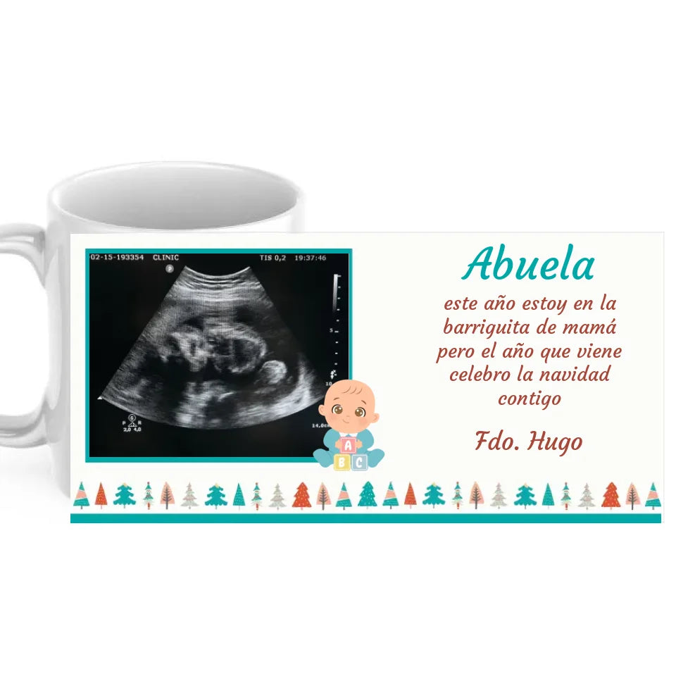 Taza ecografía navidad con dedicatoria